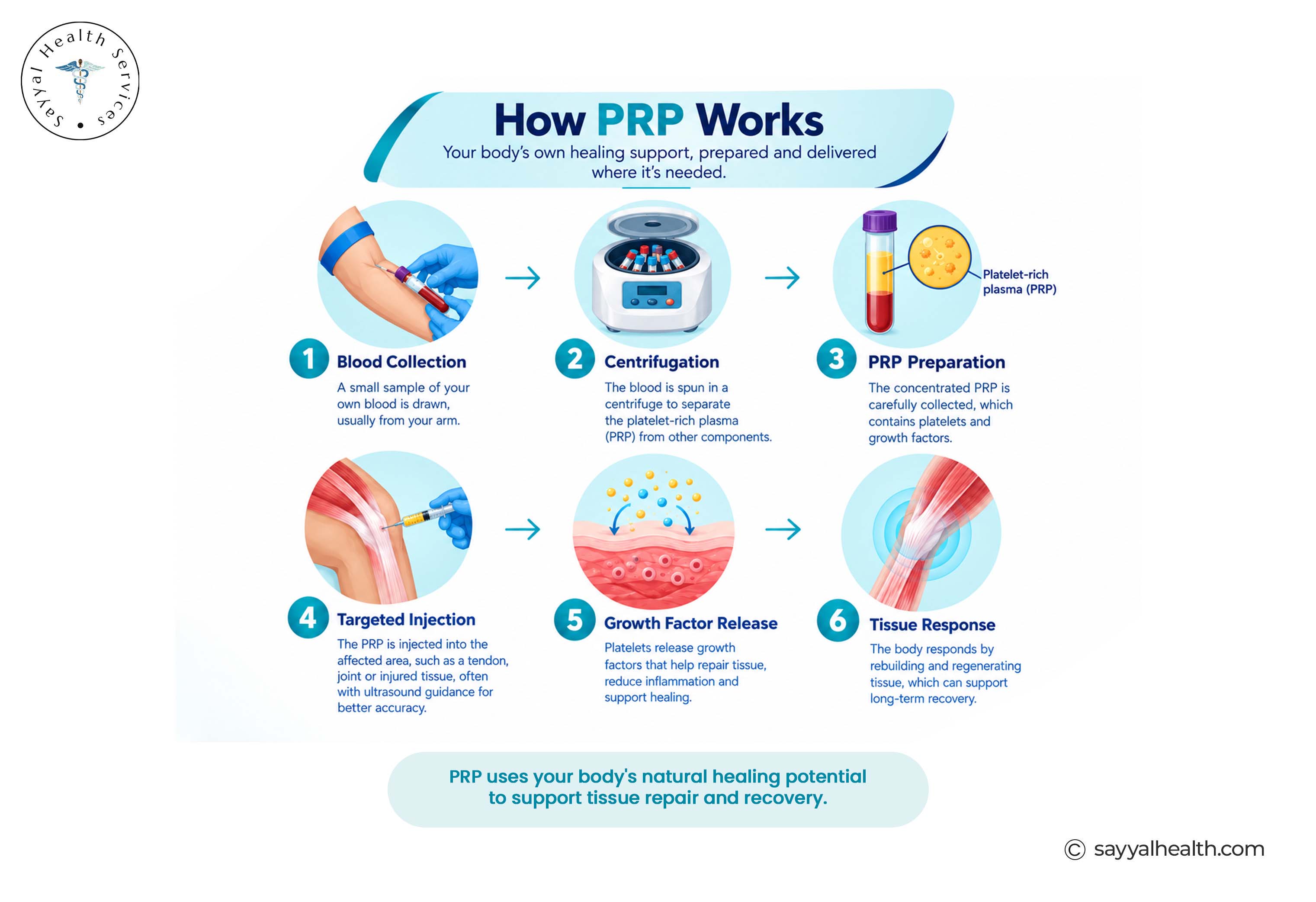 How PRP works?